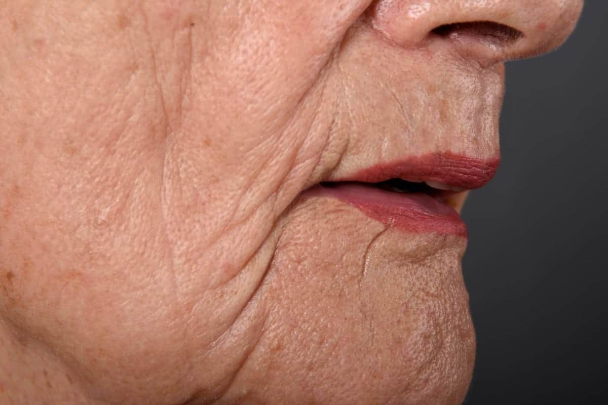 wrinkled lips?