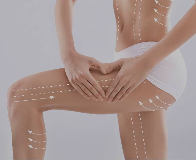 A woman displaying her body and holding her leg to demonstrate the results after the Body Flaccidity Service (BTL Exilis Ultra™) at Mark Medical Care.